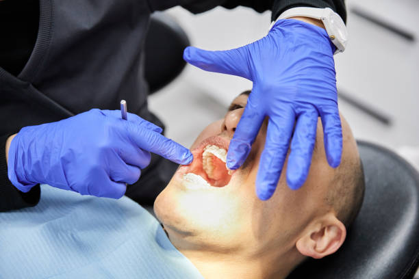 Best Emergency Dental Care for Sports Injuries in Sunrise Manor, NV