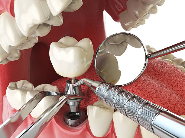 Professional Emergency Dental Service in NV